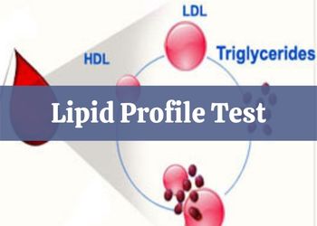 Lipid Profile Test