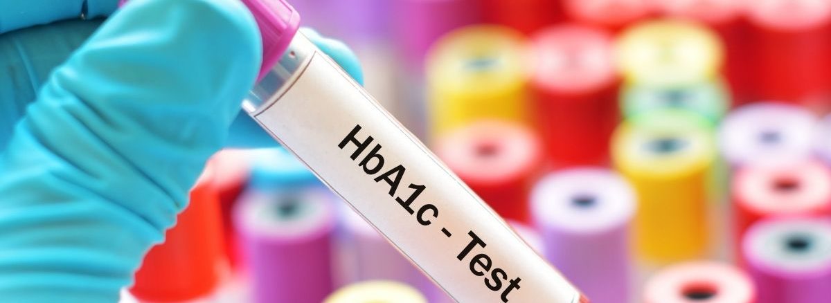 HbA1c Test For Diabetes Importance, Reference Ranges,Specimen Type and Causes (1)