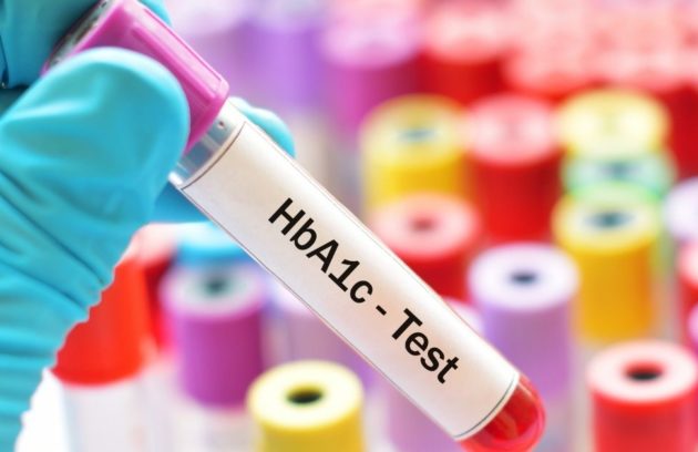 HbA1c Test For Diabetes Importance, Reference Ranges,Specimen Type and Causes (1)