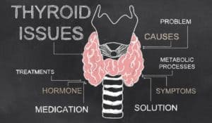What is hypothyroidism? Symptoms, Causes, Diagnosis and Treatment